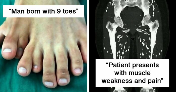 “Longest Neck In The World”: 41 Fascinating But Slightly Disturbing Medical Visuals (New Pics)