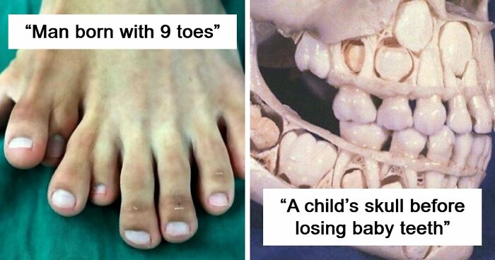 “Green Hairy Tongue!”: These 41 Medical Images That Should Be Viewed With Caution (New Pics)