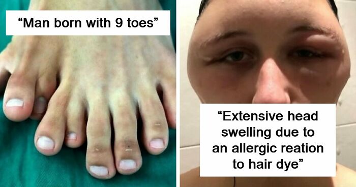 “Green Hairy Tongue!”: These 41 Medical Images That Should Be Viewed With Caution (New Pics)