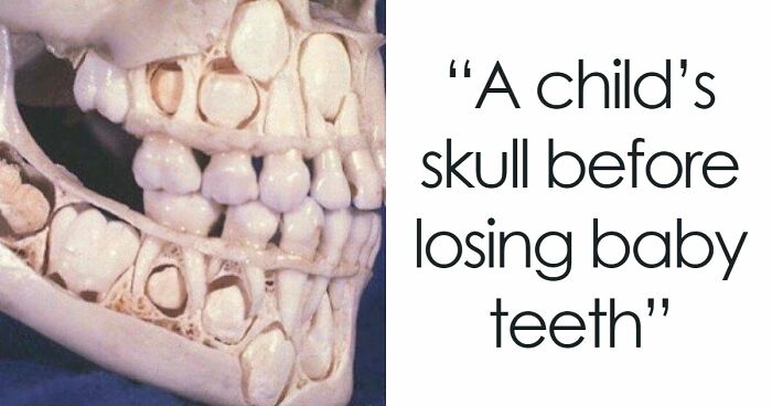 “Green Hairy Tongue!”: These 41 Medical Images That Should Be Viewed With Caution (New Pics)