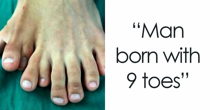 “Green Hairy Tongue!”: These 41 Medical Images That Should Be Viewed With Caution (New Pics)