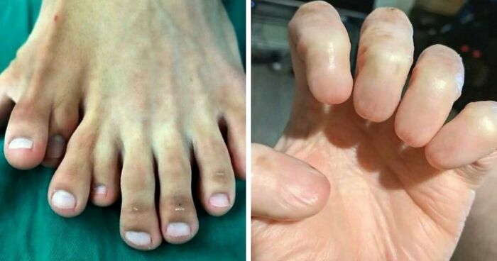 “Green Hairy Tongue!”: These 41 Medical Images That Should Be Viewed With Caution (New Pics)