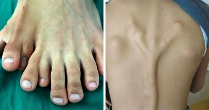 “Green Hairy Tongue!”: These 41 Medical Images That Should Be Viewed With Caution (New Pics)