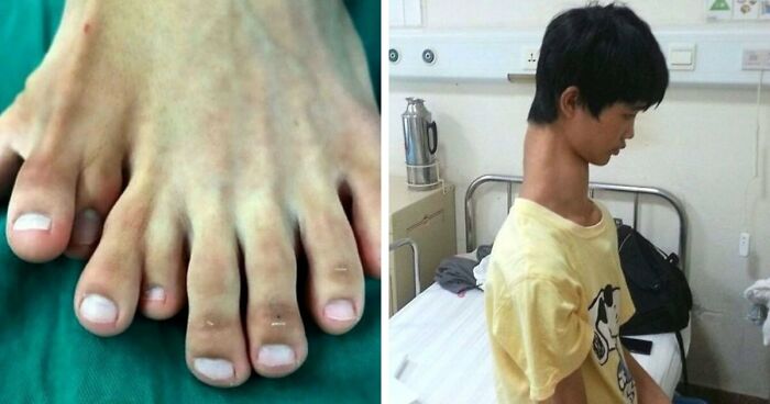 “Green Hairy Tongue!”: These 41 Medical Images That Should Be Viewed With Caution (New Pics)