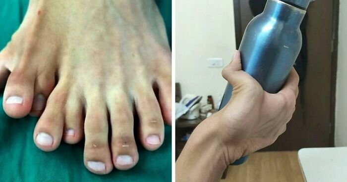 “Green Hairy Tongue!”: These 41 Medical Images That Should Be Viewed With Caution (New Pics)