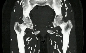 “Longest Neck In The World”: 41 Fascinating But Slightly Disturbing Medical Visuals (New Pics)