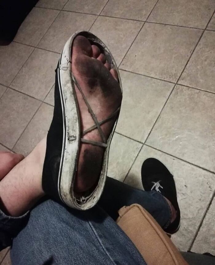 Dirty foot visible through the worn-out sole of a shoe, showing a weird and cringey moment in an unusual photo.