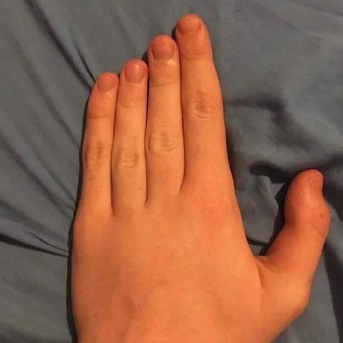 Hand with an extra finger lying on a blue fabric background, one of the weird and cringey photos difficult to look at.