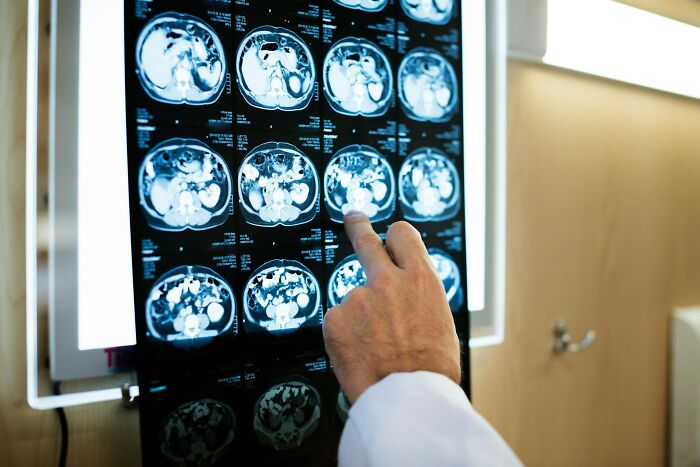 Doctor pointing at mystery medical scan images displayed on a lightbox, highlighting unexplained phenomenon in radiology.