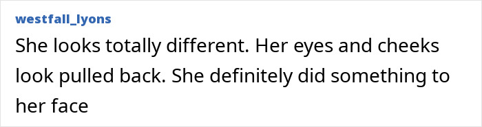 Comment text on a white background discussing changes to Anne Hathaway&rsquo;s face after her Oscars appearance.