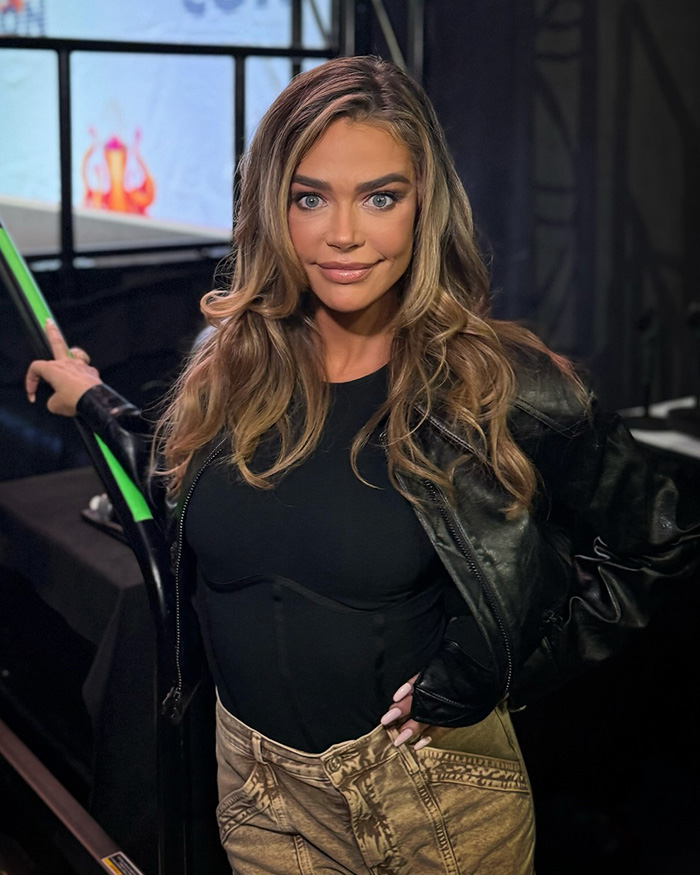 Denise Richards revela transformação dramática do facelift em fotos de antes e depois