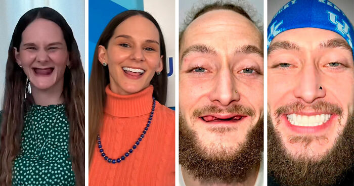 53 Dental Transformations That Led To Striking Glow-Ups