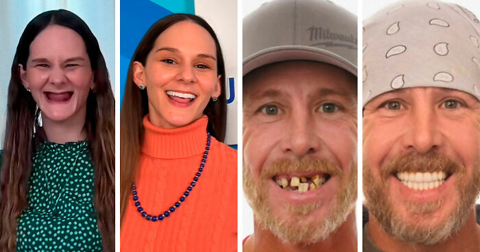53 Dental Transformations That Led To Striking Glow-Ups