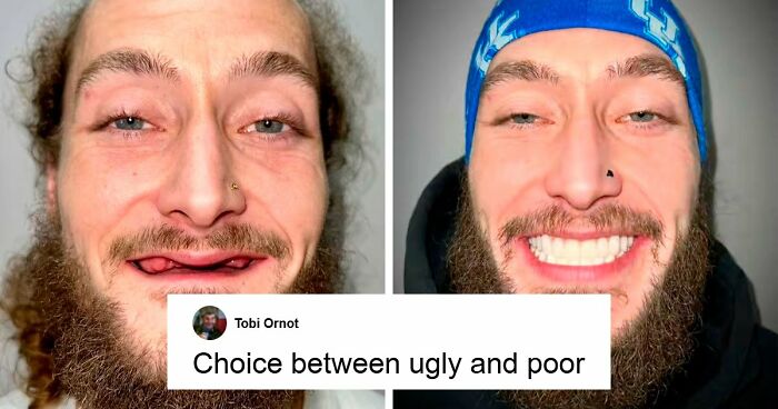 53 Dental Transformations That Led To Striking Glow-Ups