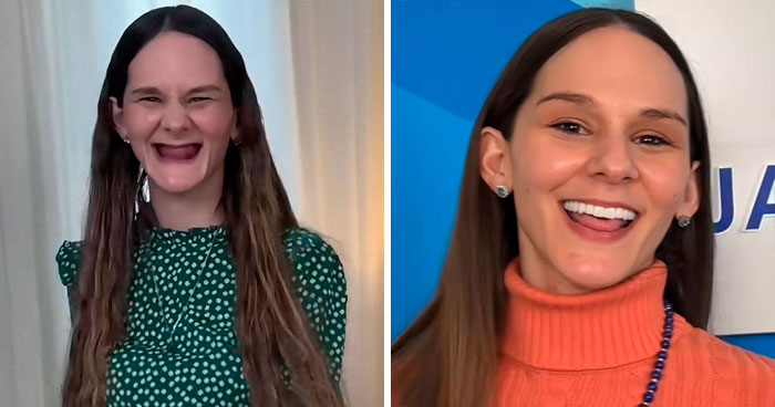 53 Dental Transformations That Led To Striking Glow-Ups