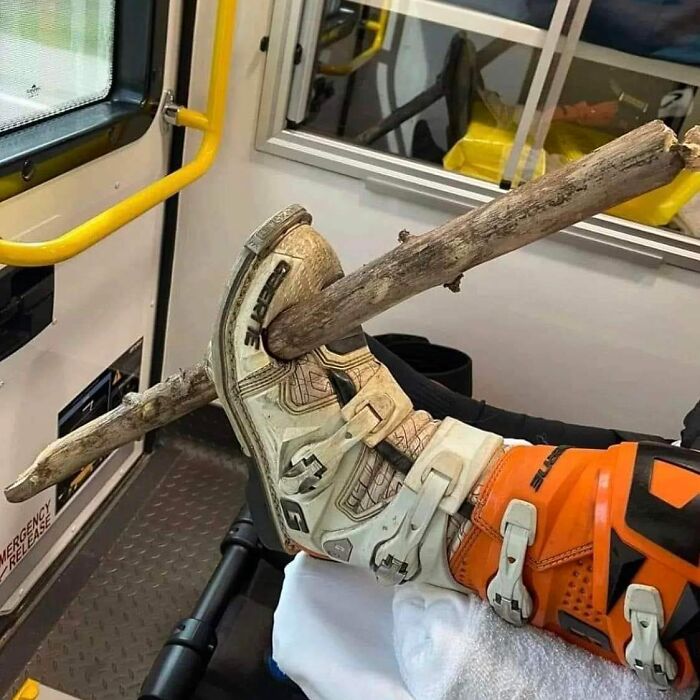Leg with a large wooden branch impaled through motocross boot, an unusual medical photo between science and nightmare.