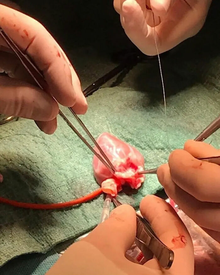 Surgeons performing a delicate operation on a small organ, showcasing unusual medical photos involving intricate medical procedures.
