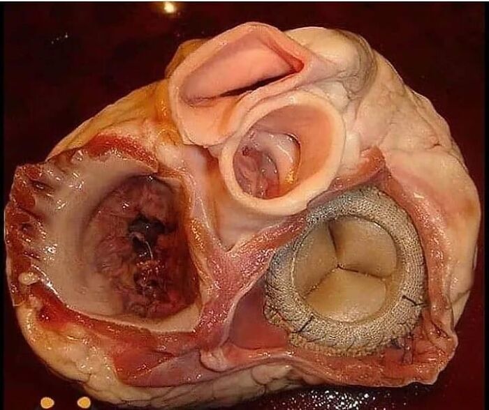 Cross-section of a heart with a mechanical valve implant, showcasing unusual medical photos blending science and anatomy.
