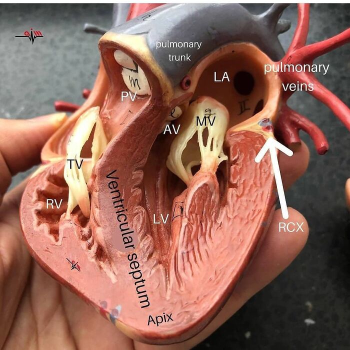 Detailed anatomical heart model showing labeled valves and chambers, an unusual medical photo blending science and nightmare elements