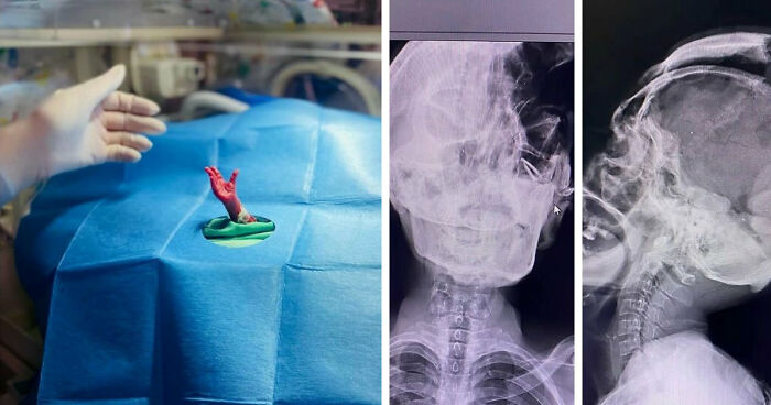 69 Unusual Medical Photos That Land Somewhere In Between Science And Nightmare