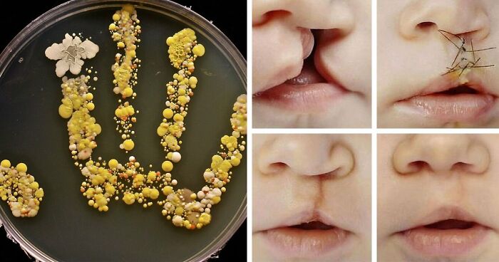 69 Unusual Medical Photos That Land Somewhere In Between Science And Nightmare