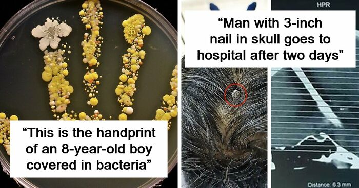 69 Unusual Medical Photos That Land Somewhere In Between Science And Nightmare