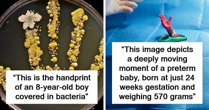 69 Unusual Medical Photos That Land Somewhere In Between Science And Nightmare