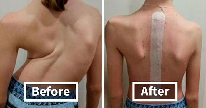 69 Medical Images And Cases That Are Equal Parts Fascinating And Deeply Disturbing