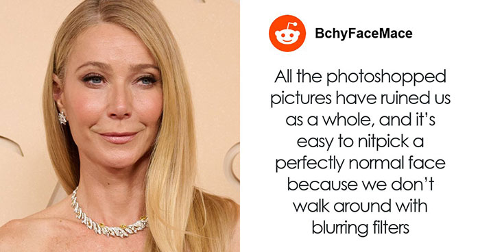 “Gives Uncanny Valley”: Experts Explain Why Stars Are Looking Strangely “Tired” Despite Youthful Skin