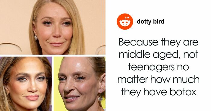 Doctor Reveals Reason Behind “Tired Eyes” That Has Stars Looking Sleepy Despite Youthful Faces