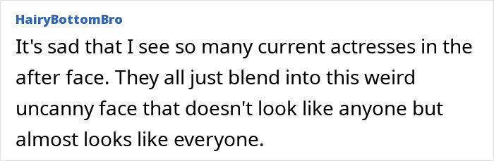 Denise Richards revela transformação dramática do facelift em fotos de antes e depois