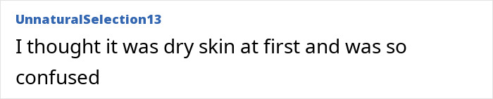 User comment expressing confusion about dry skin, related to Gwyneth Paltrow’s backstage rant and dress mishap.