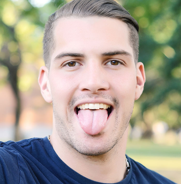 Young man making a funny face outdoors, representing awkward moments from first dates with character-building trauma.