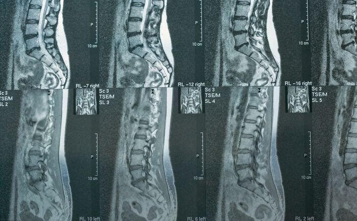 70 Ridiculous And Stupid Reasons People Ended Up In The ER