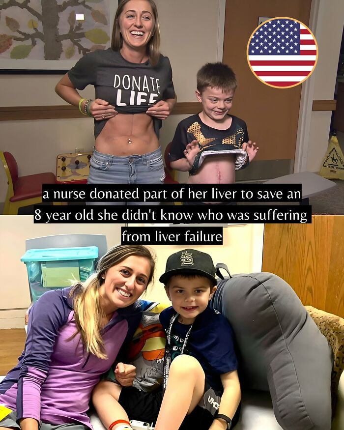 Nurse showing liver transplant scar after donating part of her liver to save an 8-year-old boy in good news story.