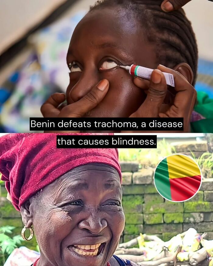 Person receiving eye treatment and smiling woman with Benin flag, highlighting good news from around the world improving life.