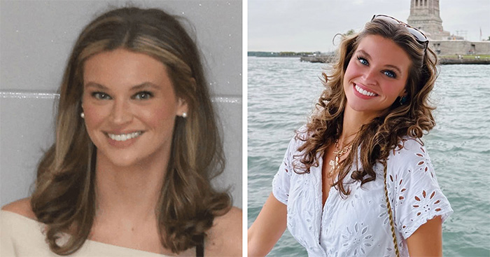 People Share 65 Photos Of The Unusual Things That Happened To Their Bodies