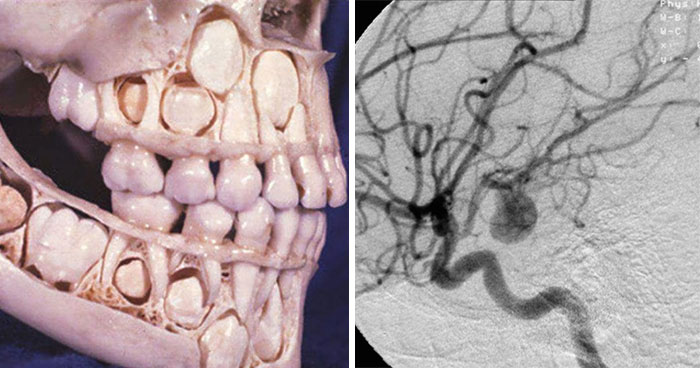 “Either God Or Evolution Is A Terrible Designer”: 59 Things That Freak People Out About Their Own Bodies