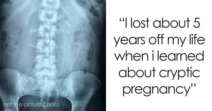 “Either God Or Evolution Is A Terrible Designer”: 59 Things That Freak People Out About Their Own Bodies