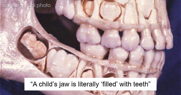 “Either God Or Evolution Is A Terrible Designer”: 59 Things That Freak People Out About Their Own Bodies