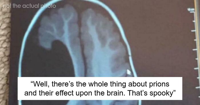 “Either God Or Evolution Is A Terrible Designer”: 59 Things That Freak People Out About Their Own Bodies