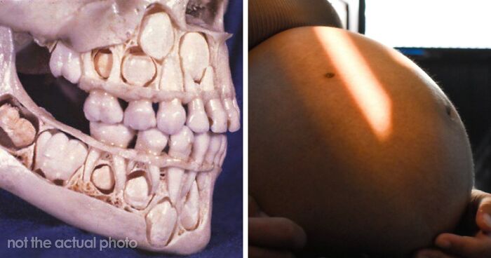 “Either God Or Evolution Is A Terrible Designer”: 59 Things That Freak People Out About Their Own Bodies