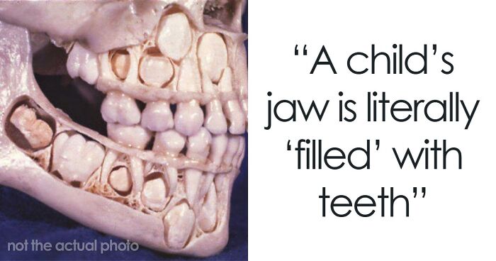 “Either God Or Evolution Is A Terrible Designer”: 59 Things That Freak People Out About Their Own Bodies