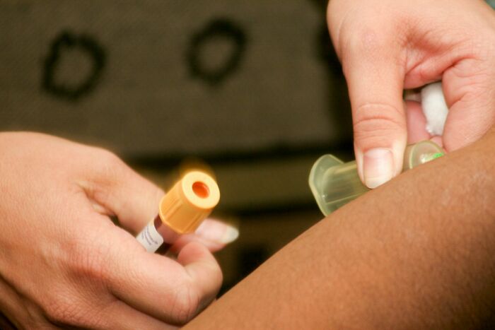 A healthcare worker drawing blood from a patient’s arm using a yellow-capped blood collection tube.