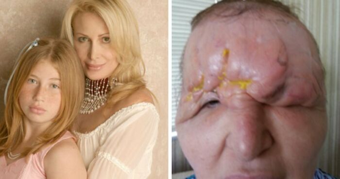 Side-by-side images showing a healthy woman and a disturbing medical condition, highlighting disturbing images and facts.