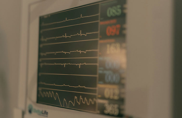 Hospital heart monitor screen displaying vital signs and ECG waveforms representing fake facts in movies.