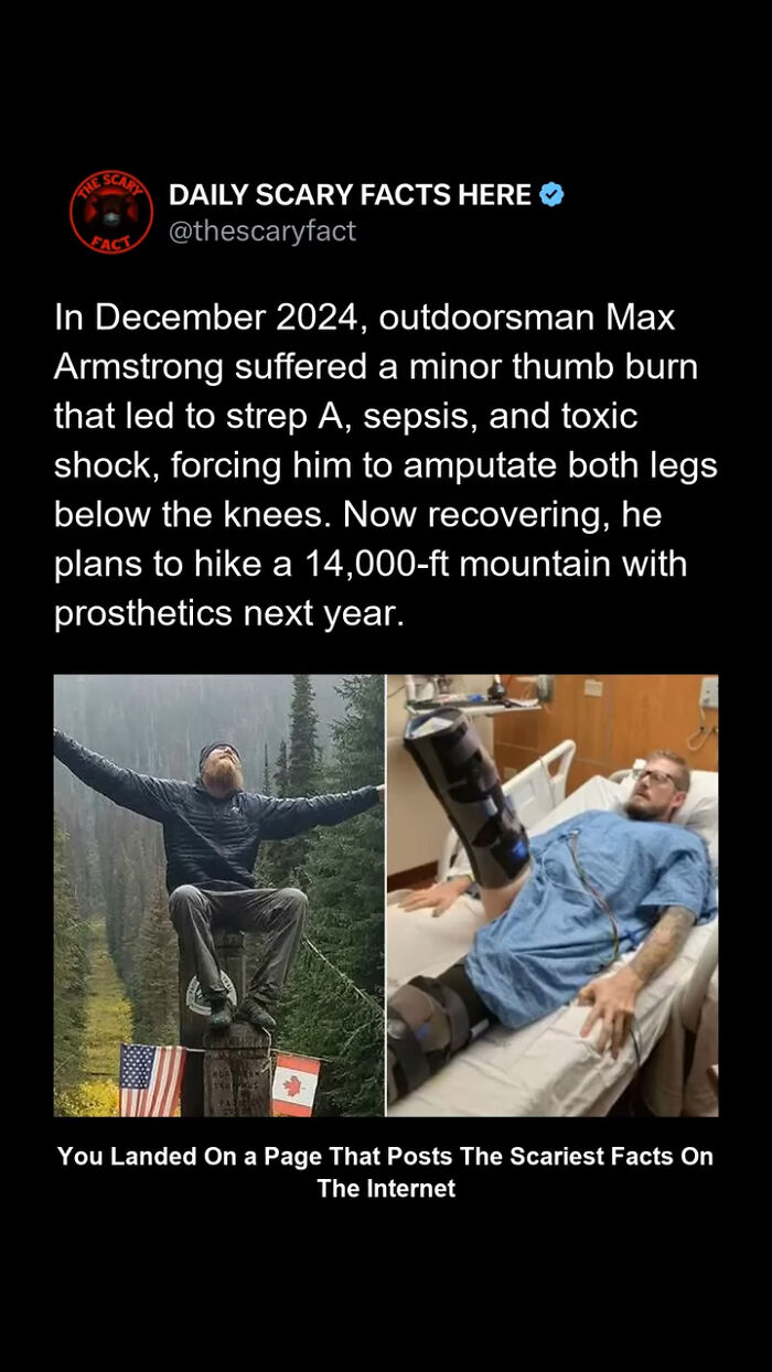 Man with leg prosthetics in hospital bed and outdoorsman celebrating on a mountain, illustrating scary facts about sepsis risks.