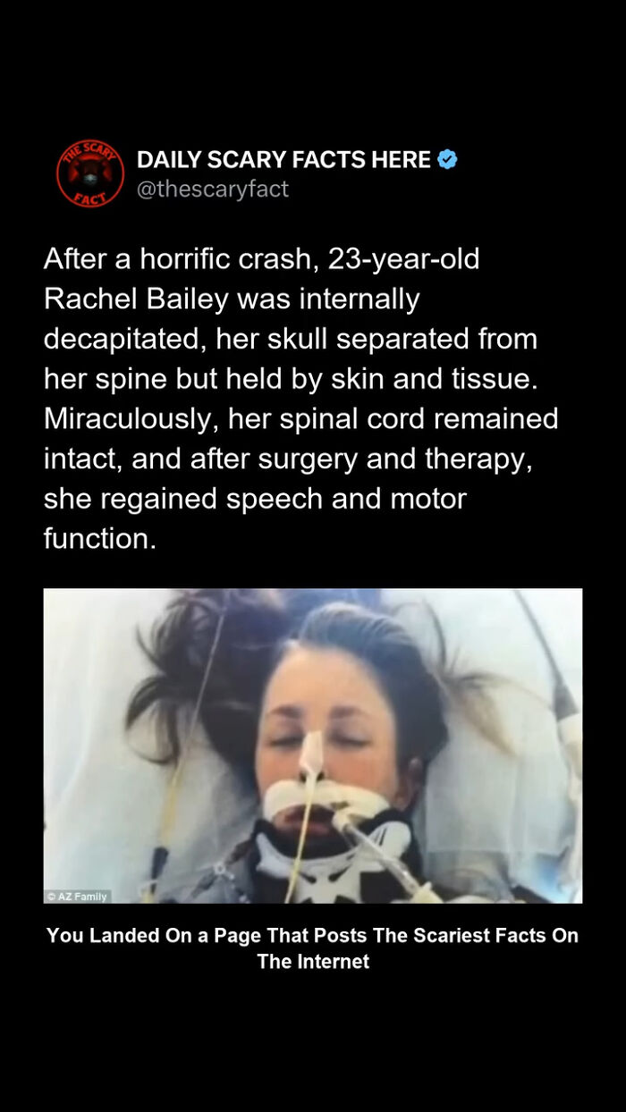 Young woman in hospital bed with neck brace and breathing tubes after a severe crash showing scary fact about survival.