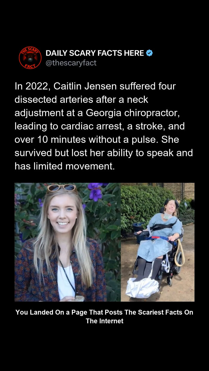 Before and after images of a woman affected by a neck adjustment causing serious injury from scary facts.