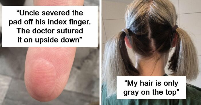 People Share 65 Photos Of The Unusual Things That Happened To Their Bodies